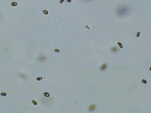 Platymonas Sp. Live Phytoplankton - Great for Feed or Science Projects!