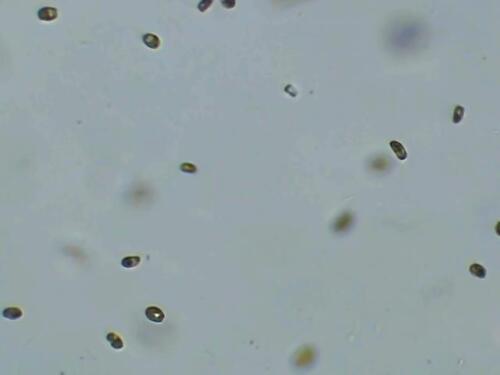 Tetraselmis Live Phytoplankton - Great for Feed or Science Projects!